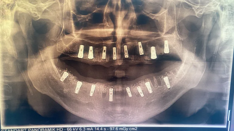 Alanya HEALTHY TEETH Dental Aesthetic — Медицина в Аланье: Онлайн-заказ, цены и отзывы